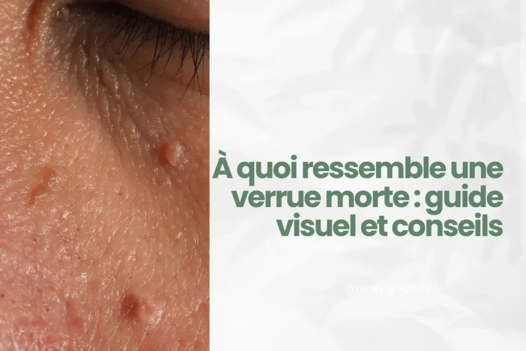 À quoi ressemble une verrue morte guide visuel et conseils